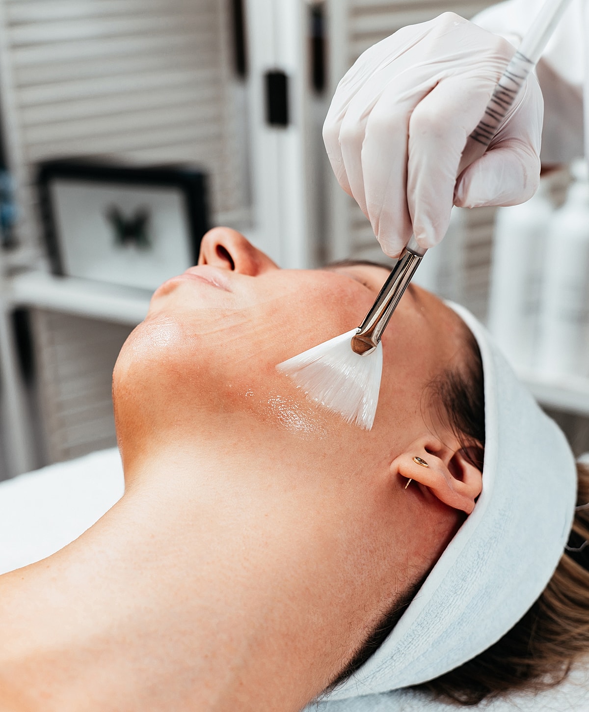 Melbourne chemical peel model receiving treatment