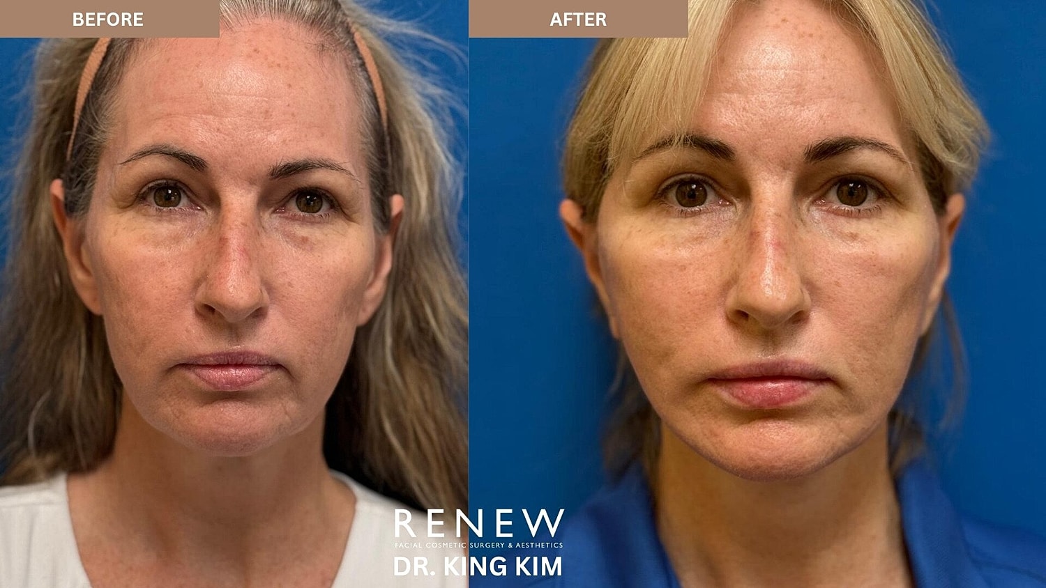 Weekend Facelift Before & After