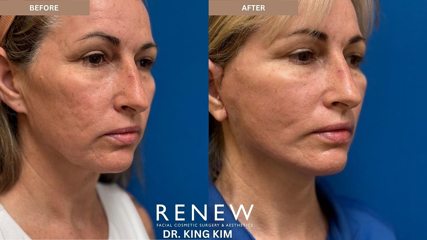 Weekend Facelift Before & After