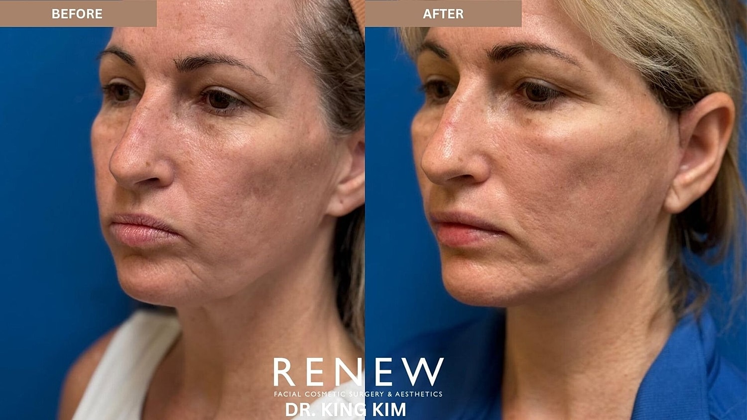 Weekend Facelift Before & After