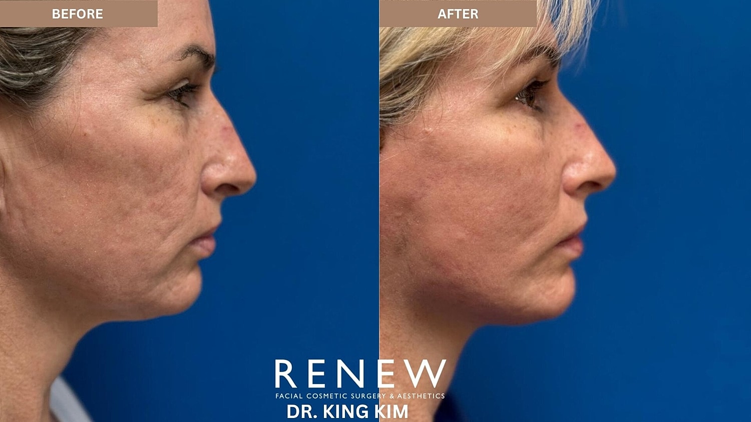 Weekend Facelift Before & After