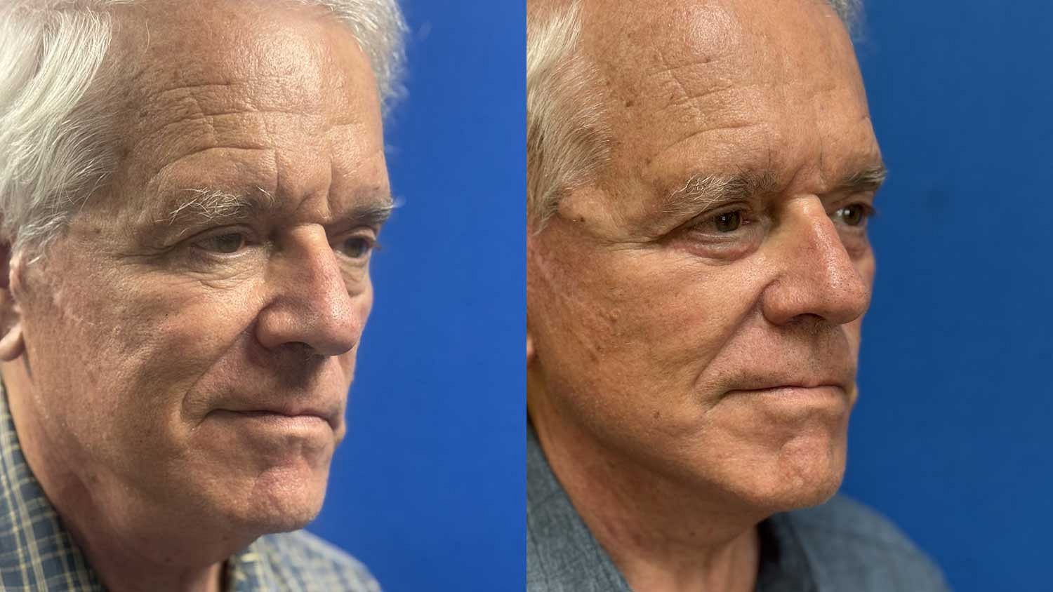 Weekend Facelift Before & After