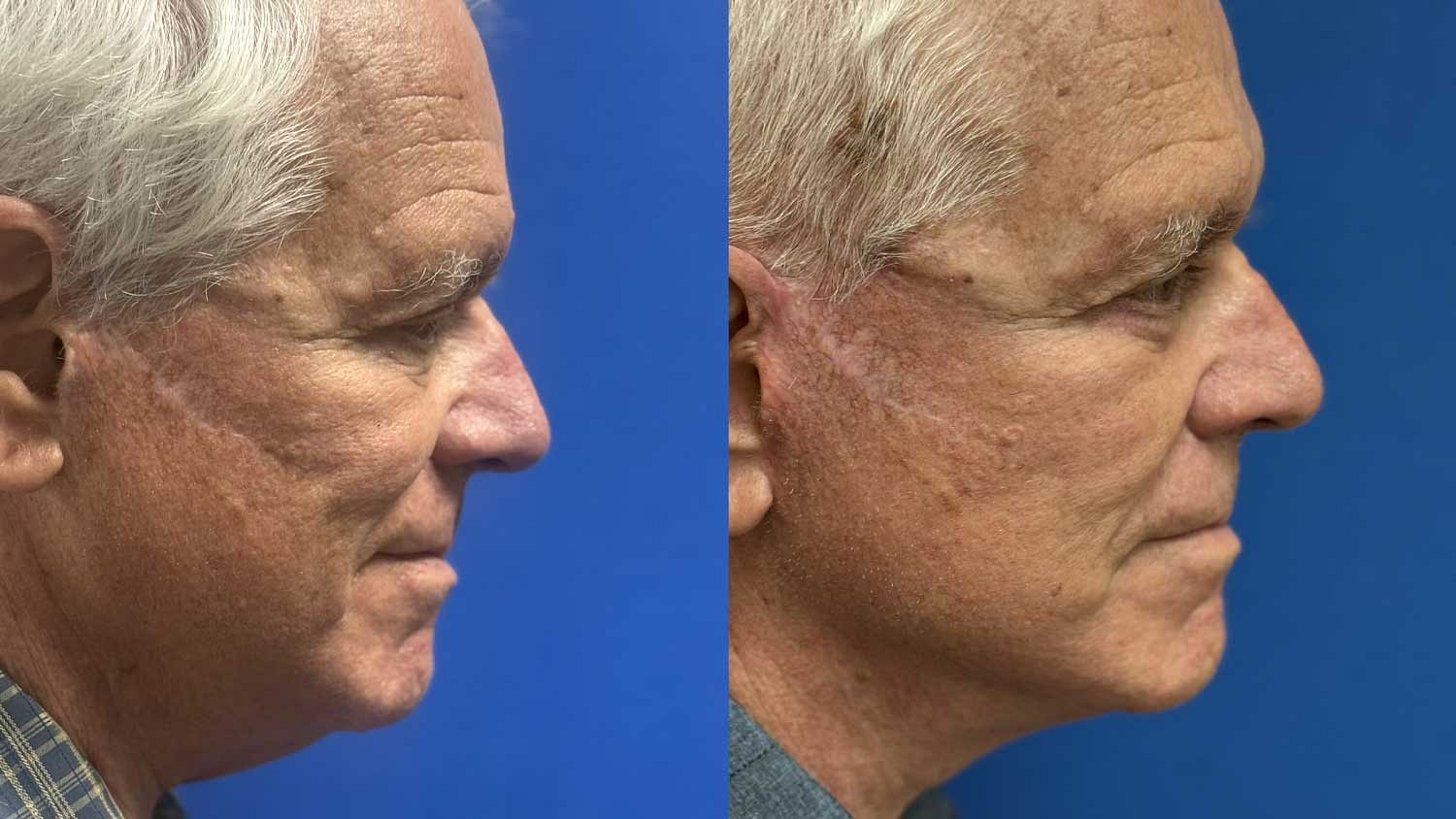 Weekend Facelift Before & After