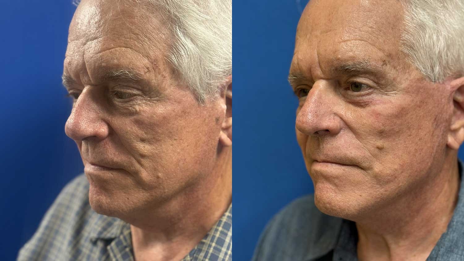 Weekend Facelift Before & After