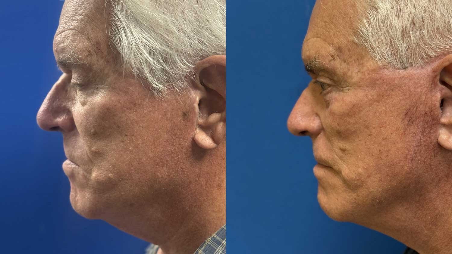 Weekend Facelift Before & After